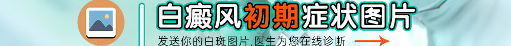 郑州西京白癜风医院